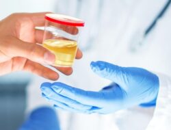 Gagal Ginjal Bisa Dilihat dari Air Kencing, Ini Ciri-cirinya