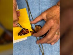 Melihat Operasi Sayap Patah Kupu-kupu hingga Bisa Terbang Lagi