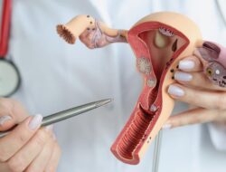 Cerita Dokter Obgyn yang Sempat Tangani Kasus Viral Rahim Copot