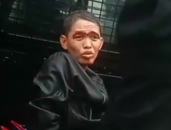 Pelaku Pembunuhan Anak Politikus PKS Idap Kanker Nasofaring Stadium 3